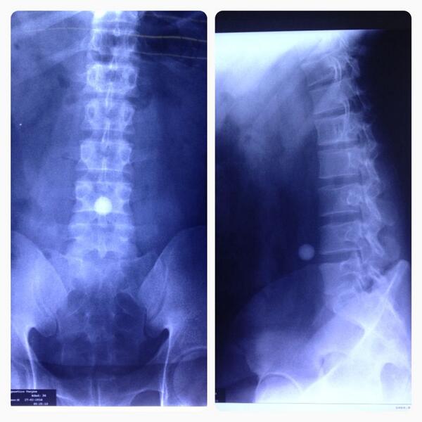 radiografiametrasrafaelgallardo