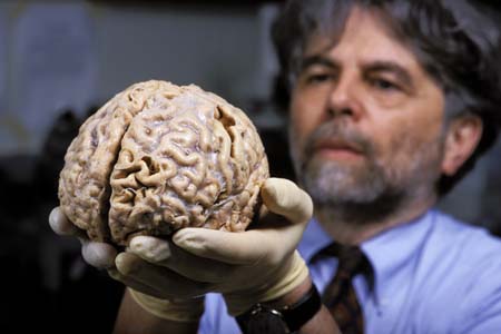 Cerebro humano consume mucha energía en infancia y retarda desarrollo físico