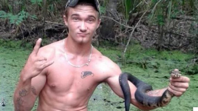 El chistocito: Se dio los besos con una serpiente y terminó desfigurado (Fotos)