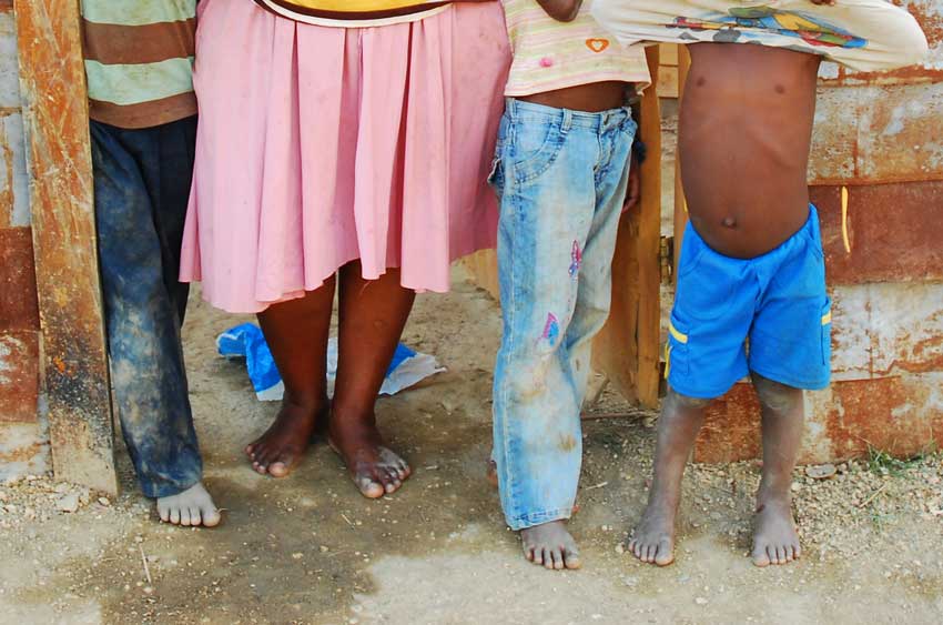 Le quemó las manos a sus hijos porque le botaron una harina de maíz