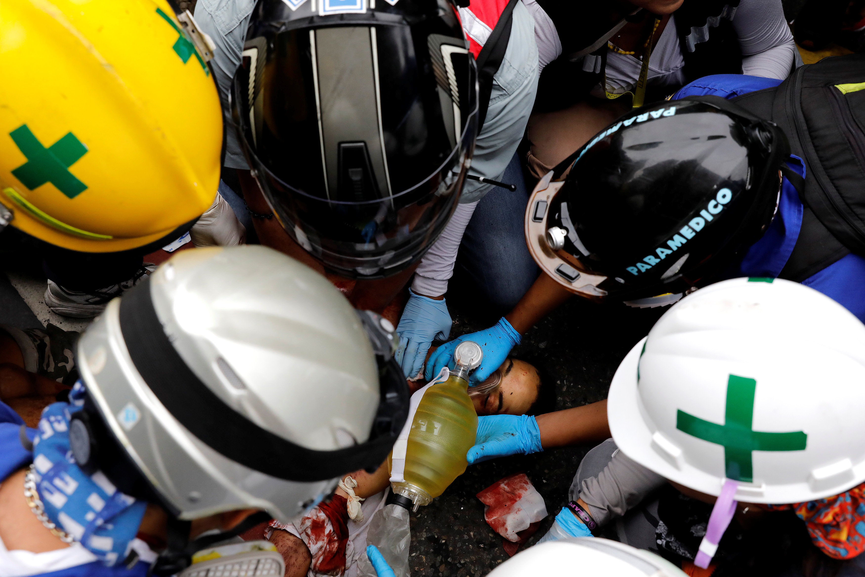 Defensor afirma que muerte de Neomar Lander no fue por lacrimógena