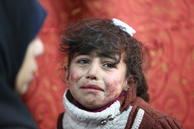 Hala, 9, receives treatment at a makeshift hospital following Syrian government bombardments on rebel-held town of Saqba, in the besieged Eastern Ghouta region on the outskirts of the capital Damascus on February 22, 2018. / AFP PHOTO / AMER ALMOHIBANY