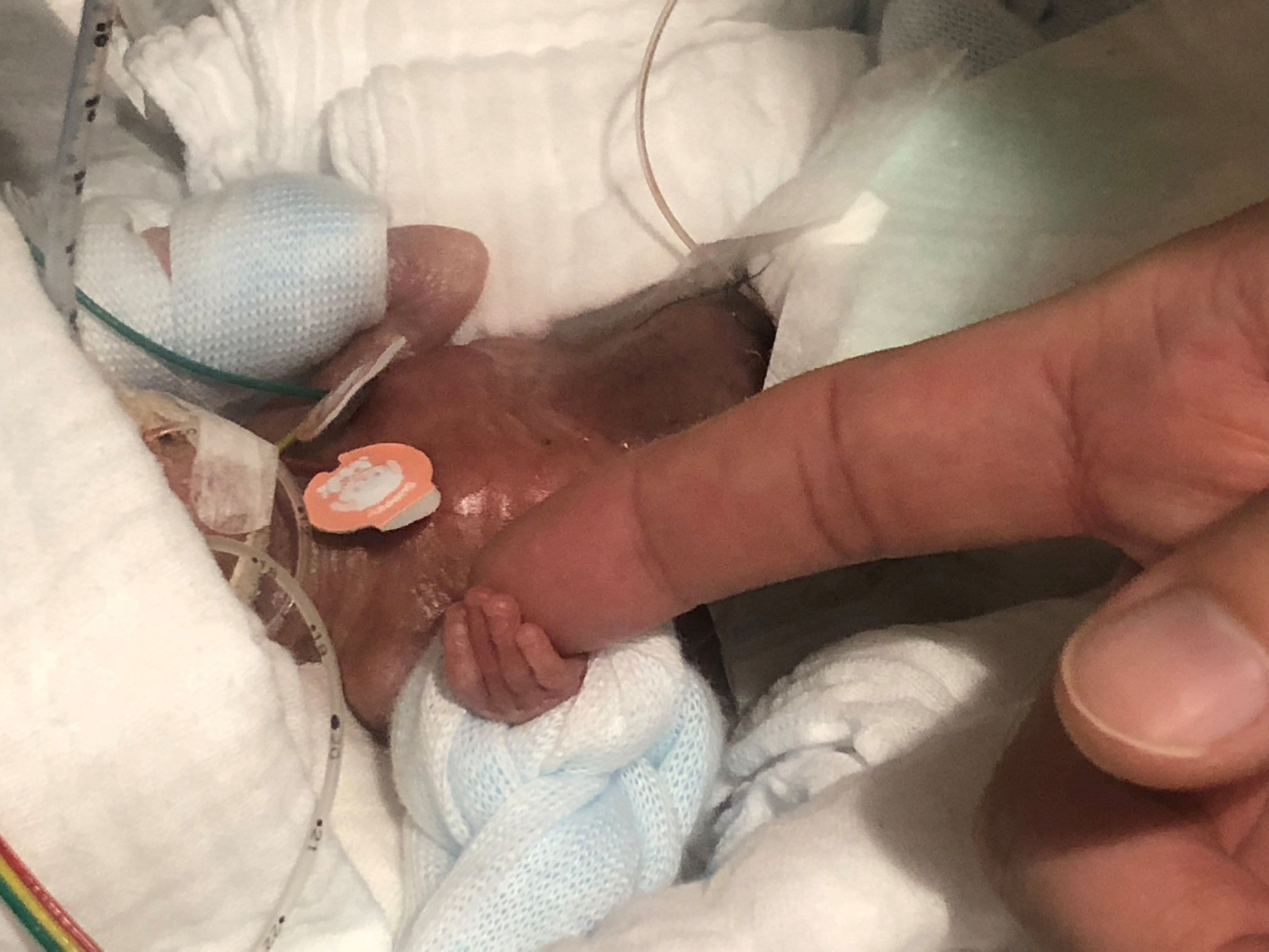 Un Bebe Que Nacio Pesando 268 Gramos Deja El Hospital Sano Y Salvo Fotos