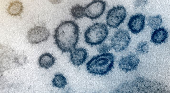 Cómo intenta el cuerpo humano salvarnos del nuevo coronavirus