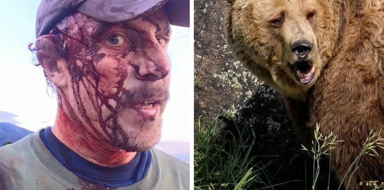 Dolor, desesperación y segundos eternos: El relato de un hombre que sobrevivió a dos ataques de un oso, el mismo día