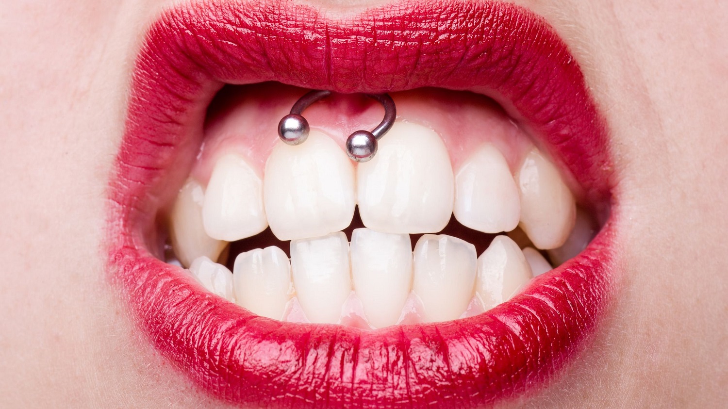 ¿Duele como dicen? Así es la nueva moda del piercing “Smiley”