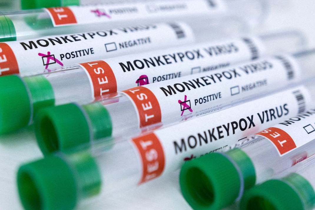 Más de 5 mil casos de viruela del mono confirmados en el mundo, anuncia la OMS