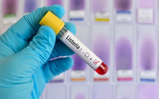 Alarma en EEUU tras el brote de listeria que dejó una muerte y 22 hospitalizaciones