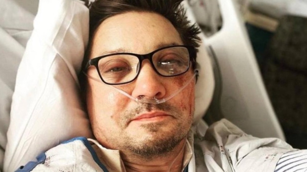 La alarmante cantidad de huesos que se rompió Jeremy Renner en el accidente con un quitanieves