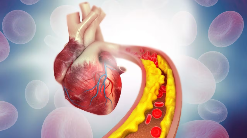 ¿Cuál es la vitamina que ayuda a reducir el colesterol “malo” y los triglicéridos?