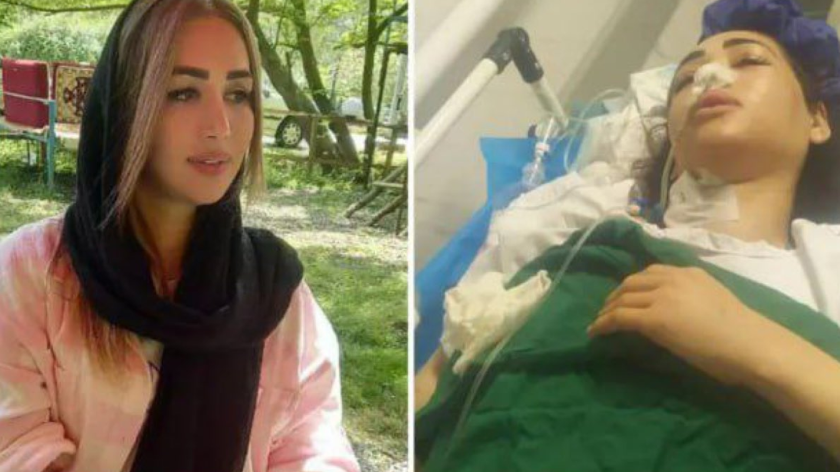 Mujer quedó paralítica tras recibir un disparo de la policía iraní: su “delito” fue no llevar hiyab