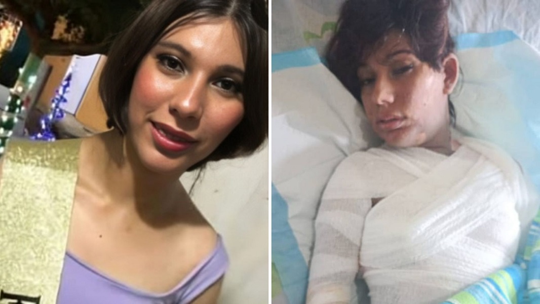 Murió María Elaine, la joven que quemó su cuerpo por un reto de TikTok